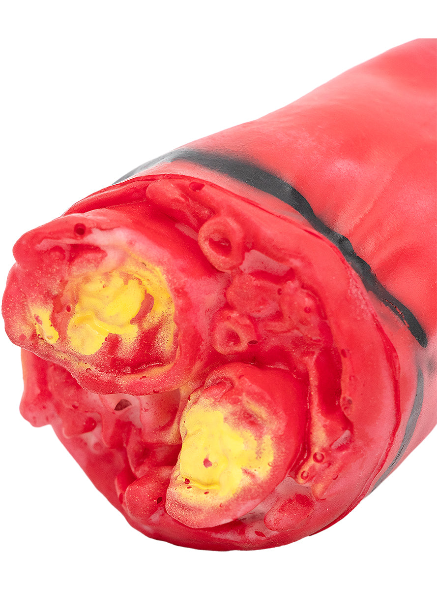 Main amputé