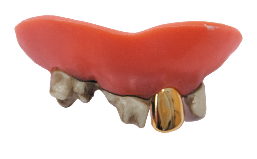 DENTIER DENTS POURRIES+OR (nécessaire de fixation inclus)