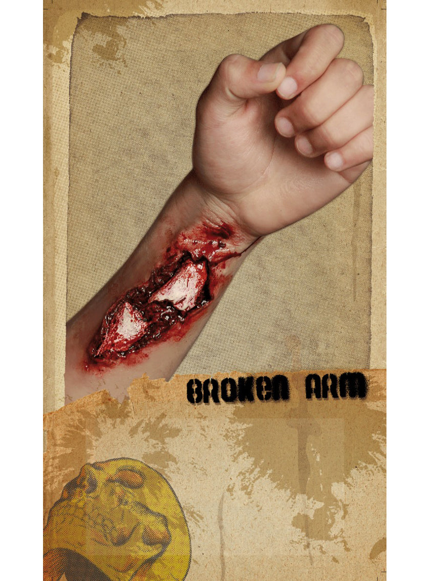 Fausse plaie bras cassé